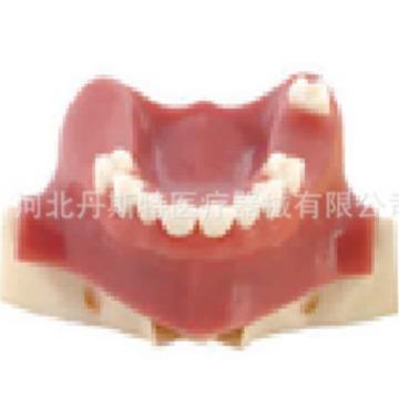 牙齿模型教学模型上颌窦练习模型