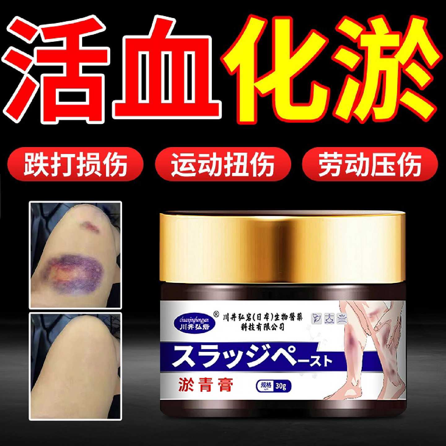 儿童淤青膏活血化瘀淤青快速消除撞伤摔伤散淤血成人消肿跌打旗舰