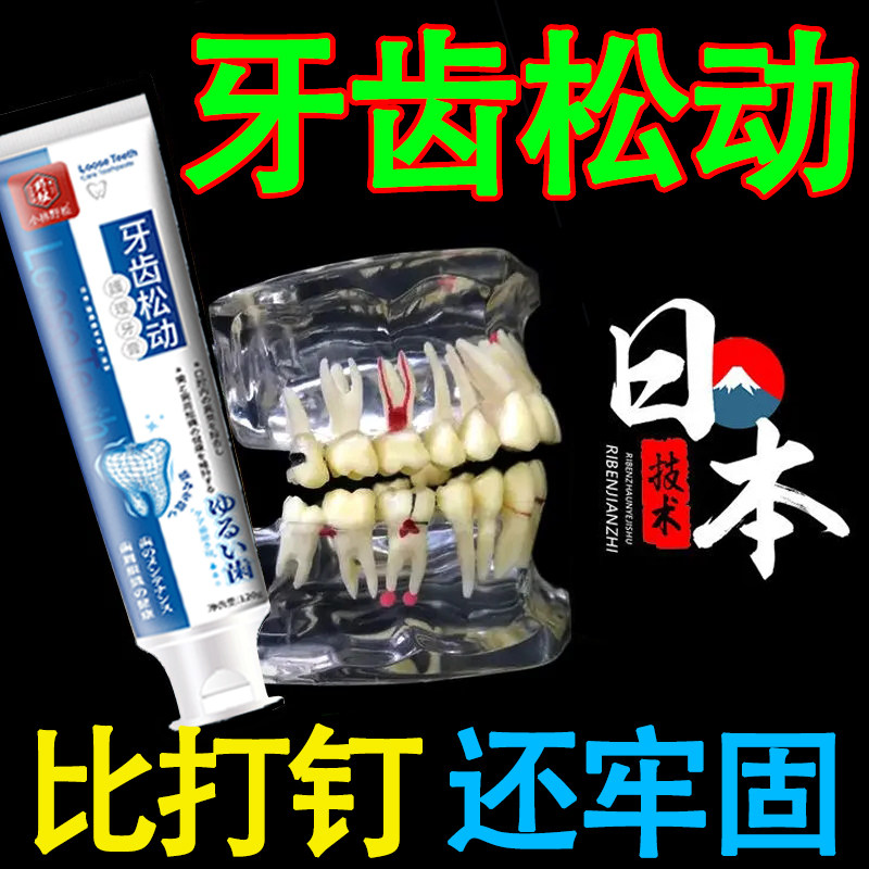 速发T度牙龈萎重】牙松动牙龈肿痛出血牙炎牙根外漏护龈固齿牙膏