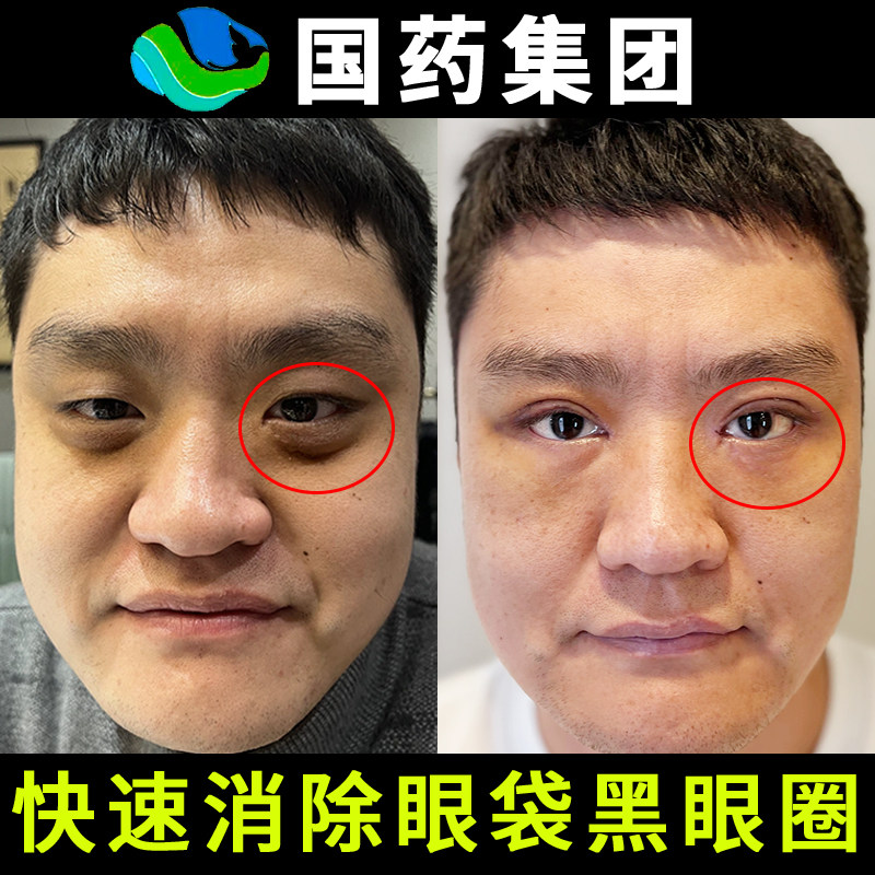 蛇毒肽强力去祛眼袋黑眼圈去除神器男士专用女士眼霜特别严重细纹