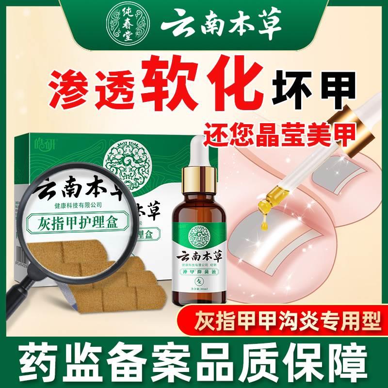 云南本草灰指甲专用液甲沟炎疗冰醋酸效脱甲膏修脚刀正品旗舰店治