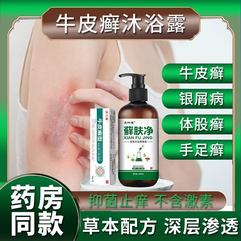 牛皮癣沐浴露治疗银屑病手足癣股藓膏大腿内侧真菌感染止痒