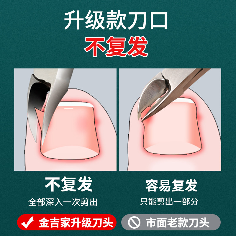 现货速发甲沟指甲刀套装脚趾甲剪鹰嘴钳家用钳子神器炎工具