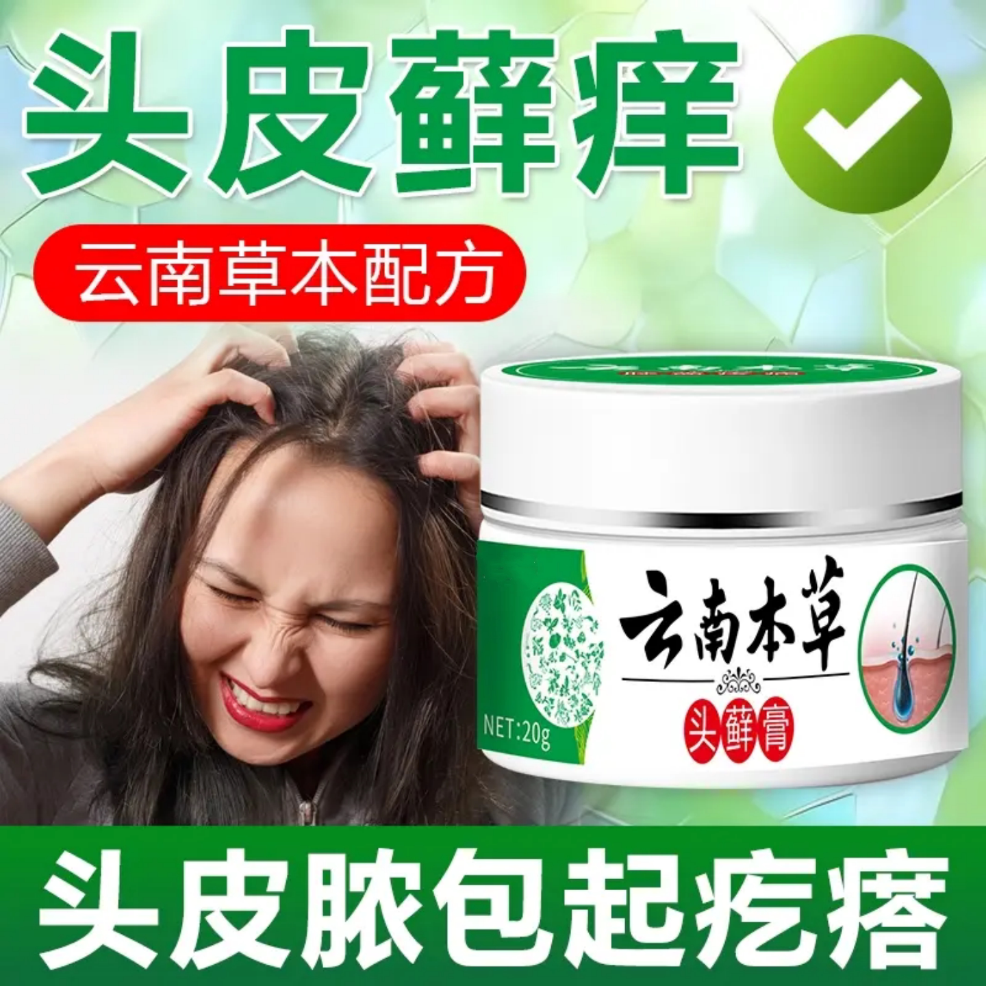 云南本草头藓膏头皮瘙痒结痂大块白色头皮屑疙瘩痒外用膏