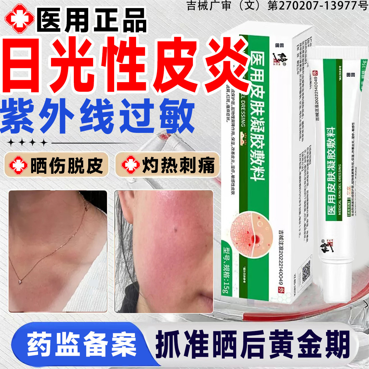 日光性皮炎特药效紫外线过敏修复霜专膏用皮肤晒伤起皮止痒医用LT