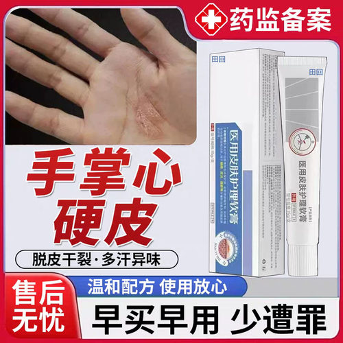 手心黄硬皮增厚角质手癣膏专用脱皮干裂真菌感染鹅掌风手癣膏药TT