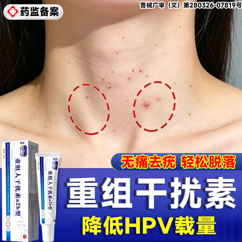 干扰素b2凝胶扁平疣尖锐湿疣a一抹灵官方旗舰店hpv去瘊肉粒药膏LT