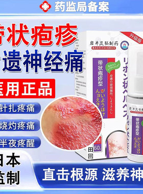 带状疱疹后遗症神经痛特效药无痛修复酶断蛇盘疮根外用膏根喷剂GX