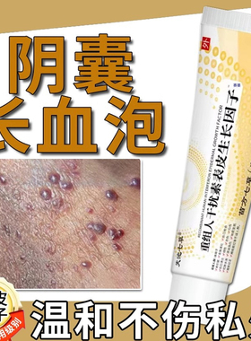 阴囊血管角化瘤阴囊睾丸血泡血热血痣红斑疼痛生殖器红硬块黑点TT