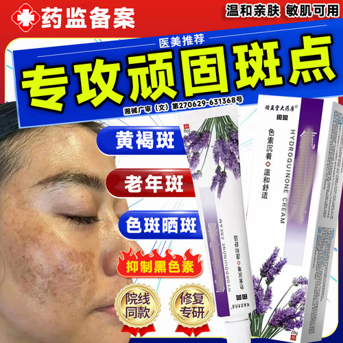 祛斑乳膏官方旗舰店正品祛斑医用级净老年黄褐色斑去淡化黑色素LT