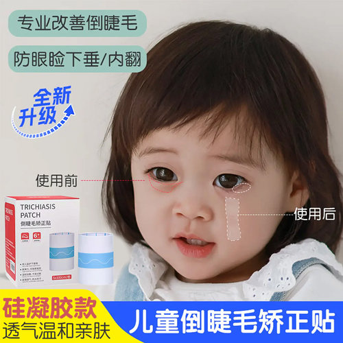 倒睫毛矫正贴儿童专用提拉下垂