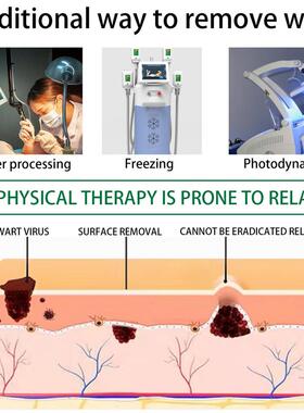 好货Wart Remover Liquid Effective Removal Of Flat Warts Reme