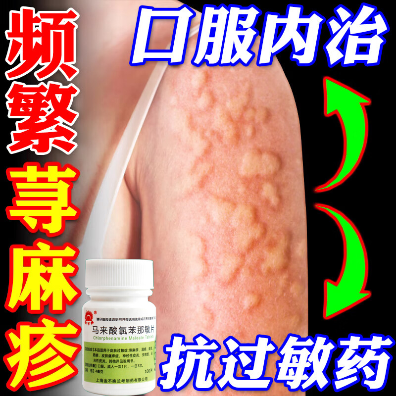 【维福佳】马来酸氯苯那敏片4mg*100片/盒