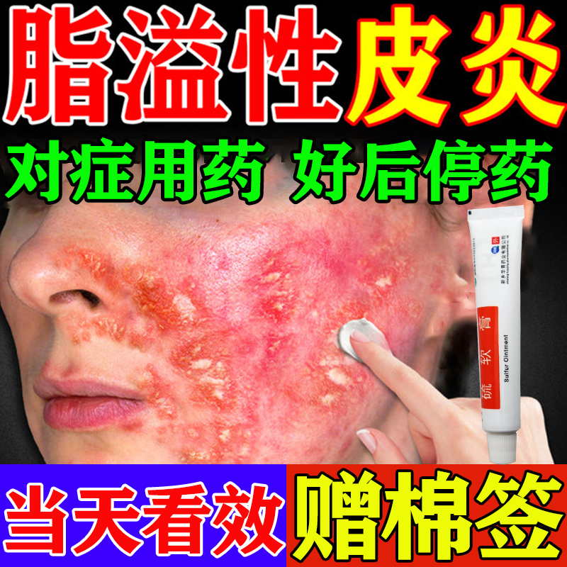 用于脂溢性皮炎、头癣、酒渣鼻等皮肤问题