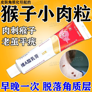 维a酸乳胶膏医用官方旗舰店去疣软膏寻常疣专用药祛痘瘊子除肉粒