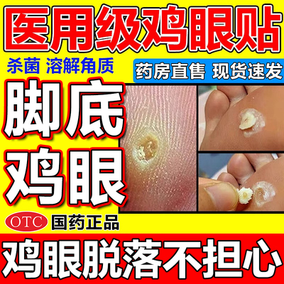 鸡眼贴治鸡眼膏脚底板脚趾鸡眼脚底不舒服死皮老茧水杨酸苯酚贴膏