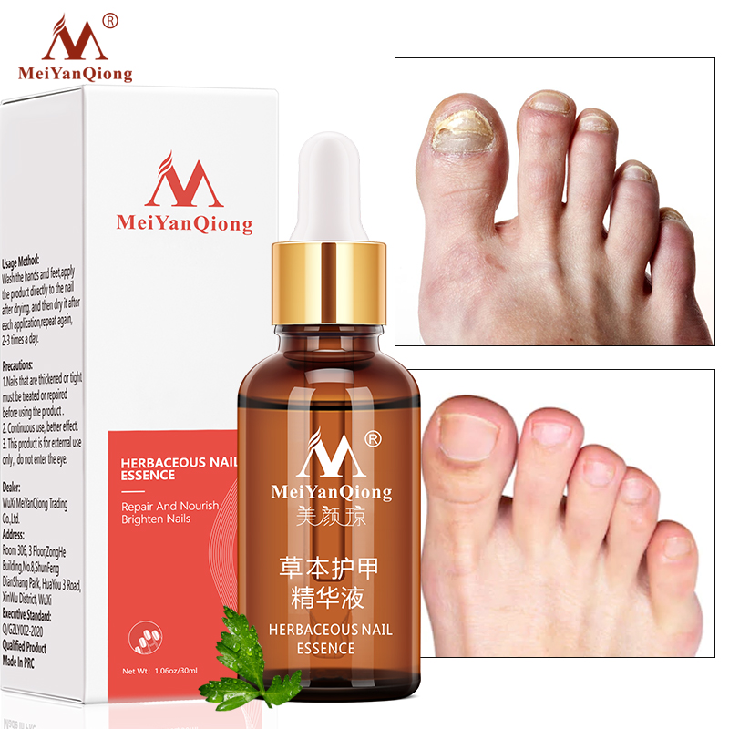 Fungal Nail Treatment Feet Care Essence Nail Foot Whitening