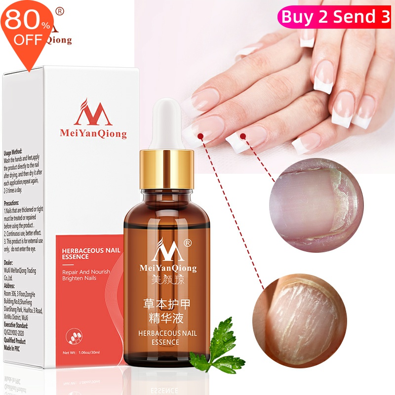 Fungal Nail Treatment Feet Care Essence Nail Foot Whitening