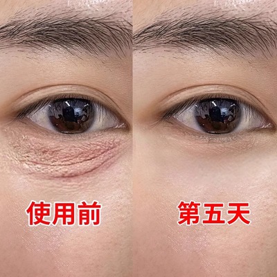 【101%告别眼纹眼圈眼袋】