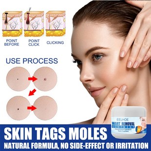 Wart Remover Safe Painless Skin Tags Removal Ointment Fast