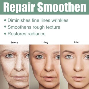 Collagen Anti-aging Essence Desalinizes Fine Lines, Moisturi