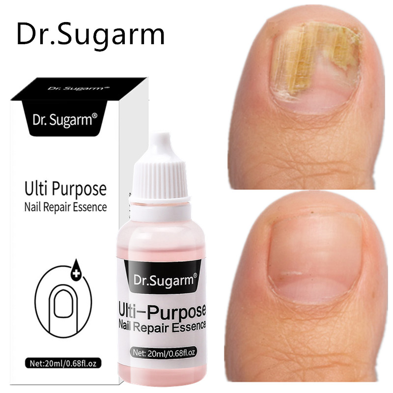 Extra Strong Nail Fungal Treatment Feet Care Essence Anti In