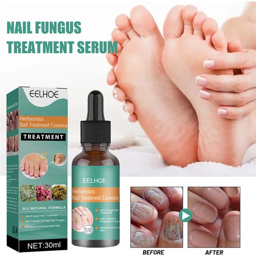 Onychomdycosis repair liquid for soft nails of hands and fee