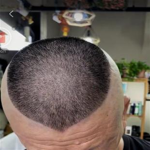 郭德纲同款理髲自己剪模具成人辅助发型模型模具头型大人头顶造型