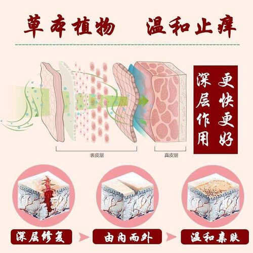 好货掌跖掌跖膏掌跖症手脚蜕皮干裂角皮症脓外用