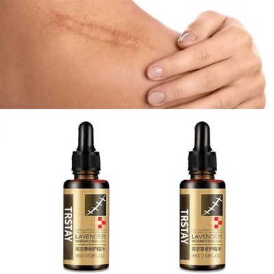 leo essencial da massagem da cicatriz da remo??o da cica