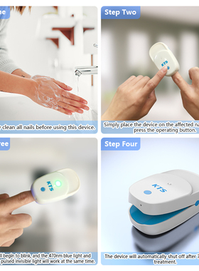 Fungal Nail Treatment Laser Device For Nail Fungus 905nm 470