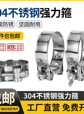 304不锈钢强力喉箍卡箍欧式抱箍软管箍管卡水管油管固定管夹卡子
