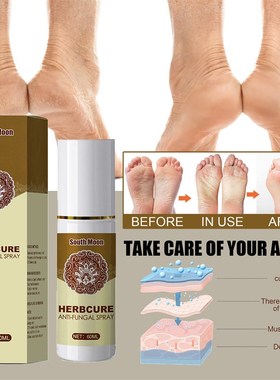 Foot Deodorizing Spray Shoes and Socks Deodorant Shoes and F