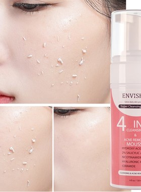ENVISHA Facial Skin Care Exfoliating Mousse Peeling Gel Deep