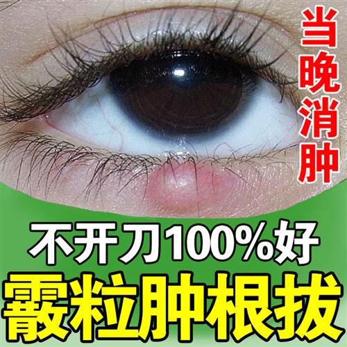 霰粒肿热敷眼膜疏通神器消除麦粒肿睑板腺囊肿堵塞眼皮红肿痒膏