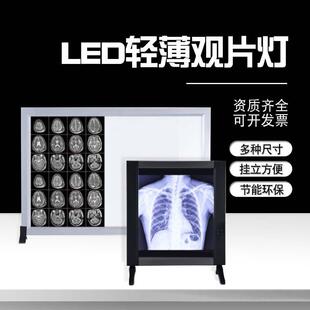 医院用LED观片灯阅片灯箱双联骨科阅片牙科看片灯x光三联观灯片