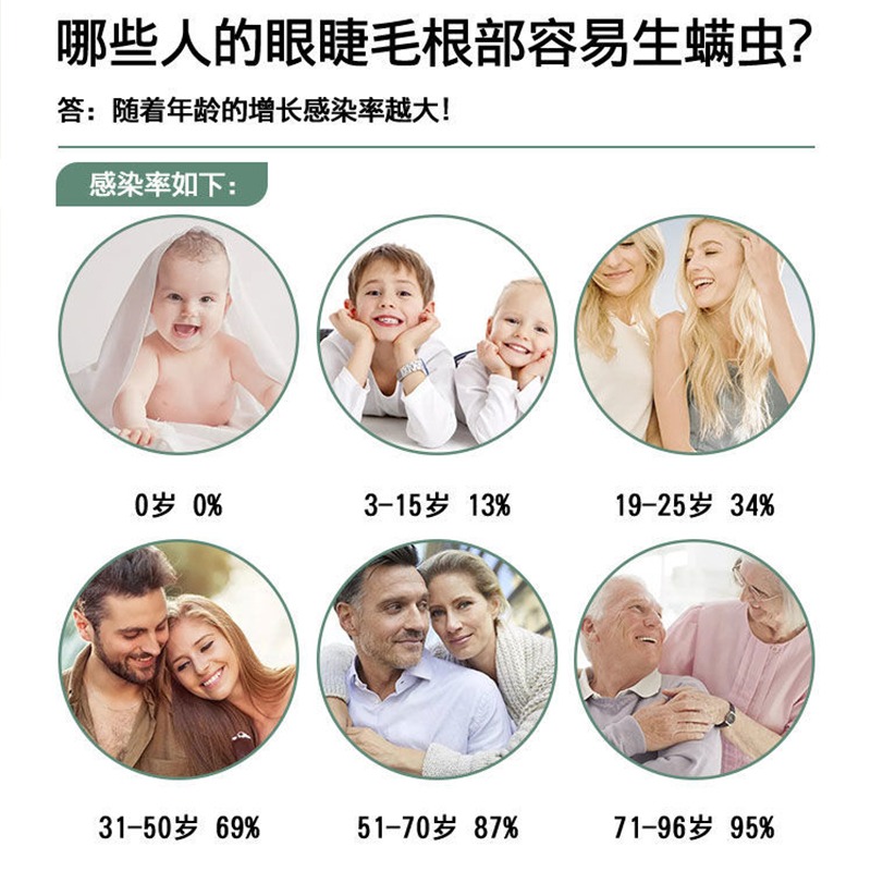 眼睛除螨洗眼液眼部专用眼干涩发痒充血过敏叶黄素去螨虫清洁止痒