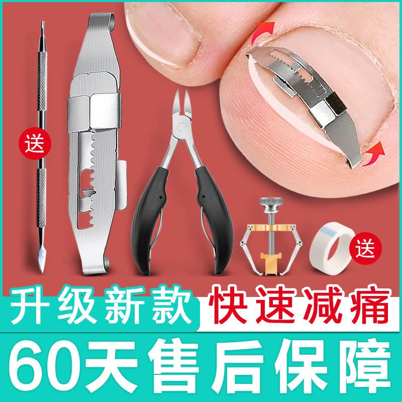 大脚趾指甲矫正器甲沟嵌甲