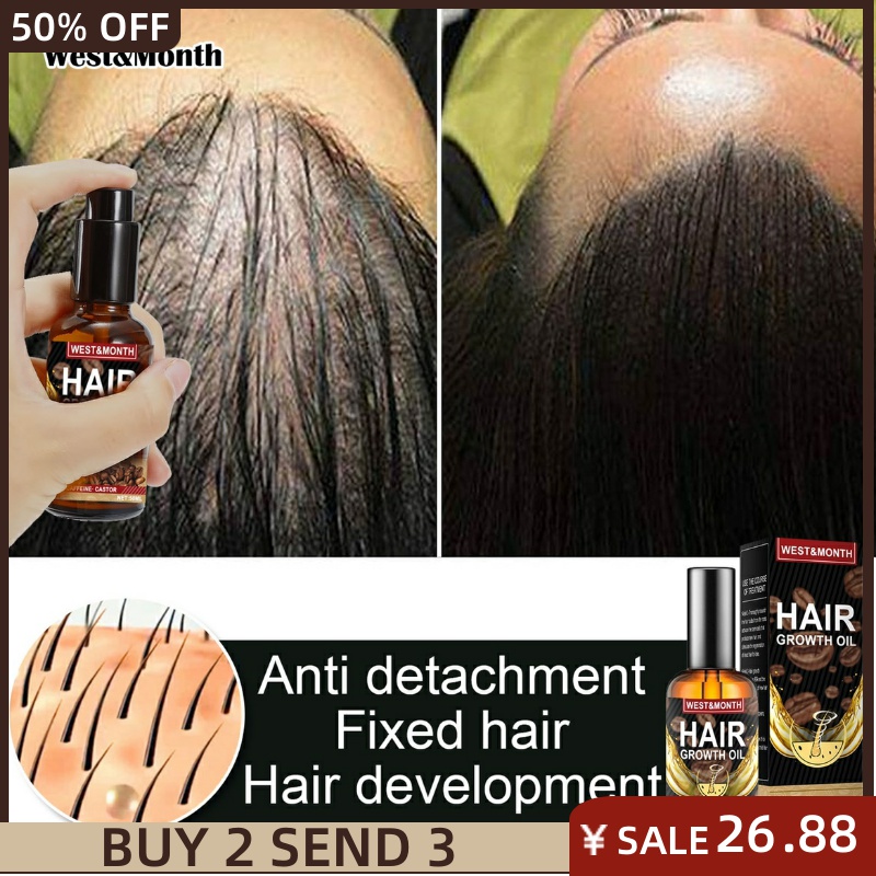 50mL Natural Essential Hair Growth Oil Ginger RegrowthSerum