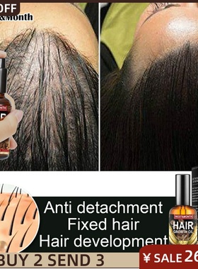 50mL Natural Essential Hair Growth Oil Ginger RegrowthSerum