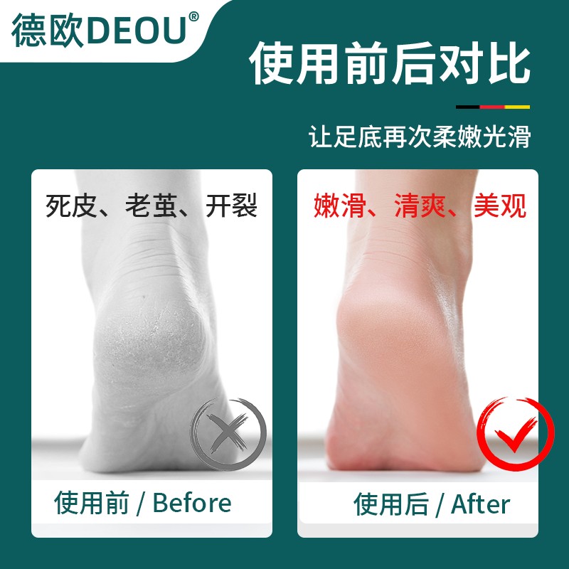 德欧DEOU品牌搓脚板去死皮老茧修脚后跟磨脚神器家用粗糙修脚工具图片