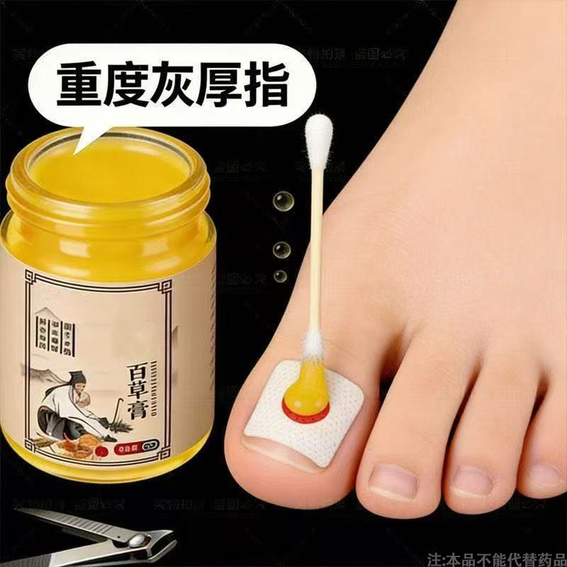 【官方正品】指甲贴正品专用灰趾膏植物萃取脚趾手指甲修护专用膏