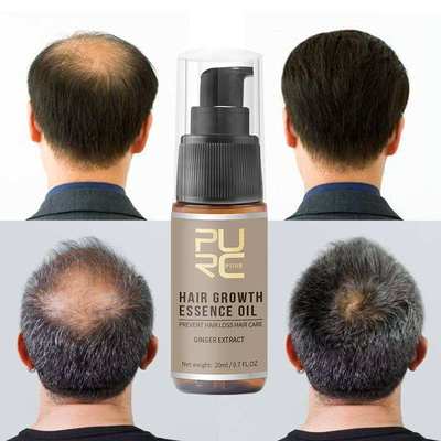 New 30ml20ml Hair Growth Spray Anti Hair Loss Ginger Preven
