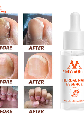 Nail Treatment Essence Serum Care Hand and Foot Care Nail Fu