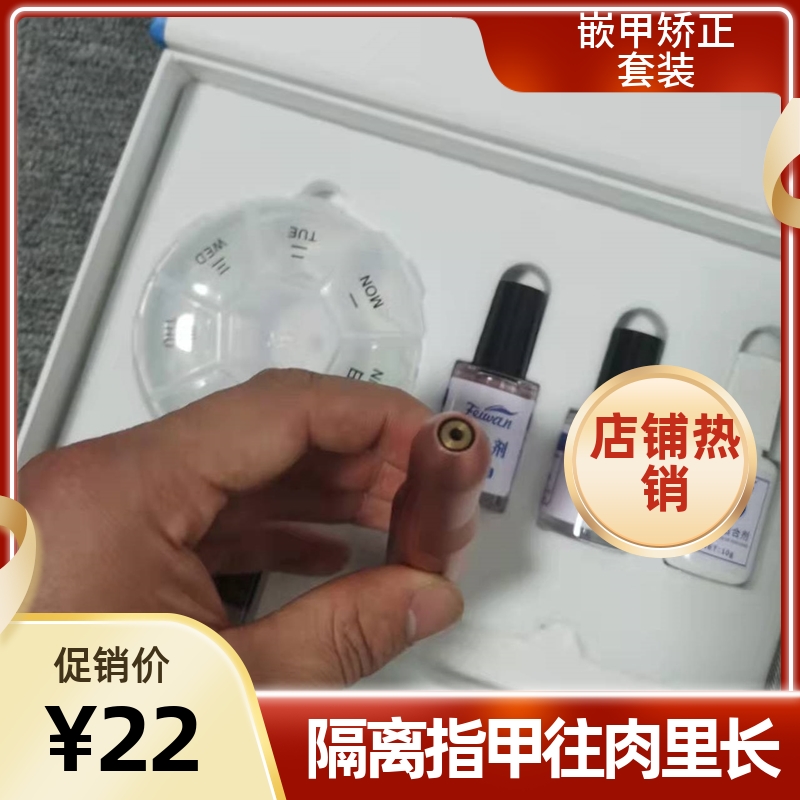 甲沟炎矫正器正甲贴拉拉贴嵌甲矫正器指甲纠正脚趾甲贴片多款套装