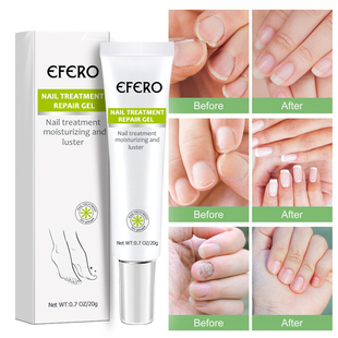 Serum Treatment Foot Fungus Fungal Removal Nail