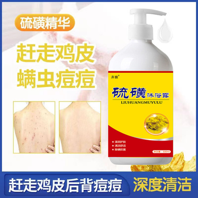 硫 磺 皁去蟎洗屁股沐浴露流黄皁上海药皁抑菌沐浴露除蟎液体皁
