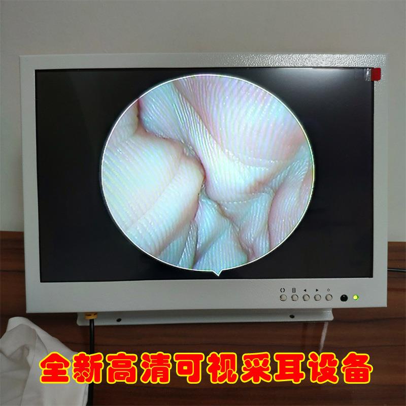 2.7mm手把高清可视采耳神套装设备掏耳工具仪器耳鼻喉