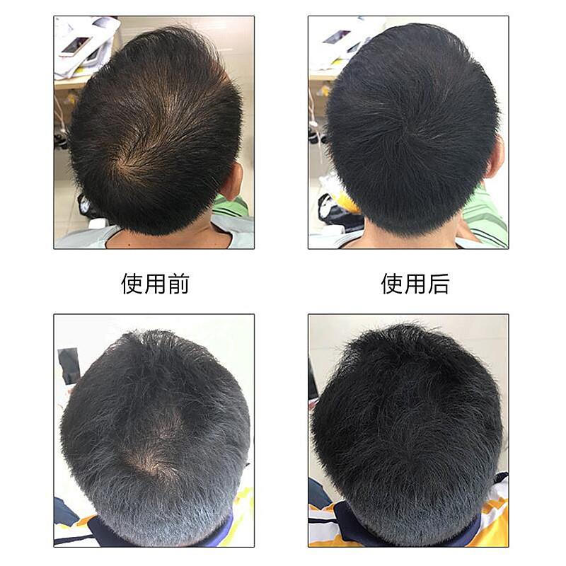 磊键密发喷雾头发快速蓬松洗头学生理髲店遮挡都能用快速蓬松纤维