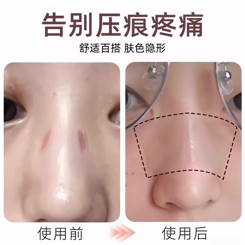 速发防压痕神器防红印鼻梁侧边垫片透明隐形贴成人儿童阅读作业看